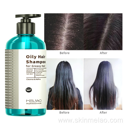 Oily Hair Shampoo For Greasy Hair